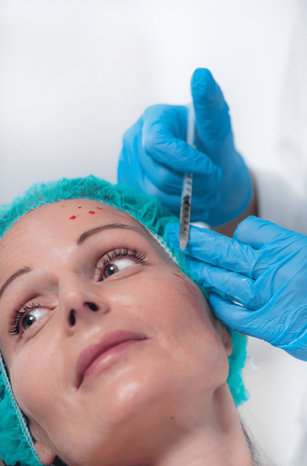 Tratamiento de bioestimulación facial